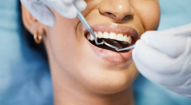 Best Emergency Tooth Extraction in Oakdale, CA